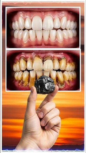 WHITEN Teeth in 1 Minute with Charcoal & Lemon! 🍋 (The Black Paste Secret 🤫) #shorts