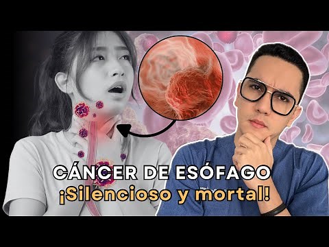 Cáncer de esófago, silencioso y mortal | Dr. William Guerrero
