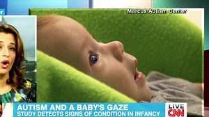 Signs of autism detected at two months