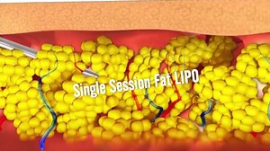 768K views · 1.6K reactions | Mr. Ahmed told us, he had tried all...