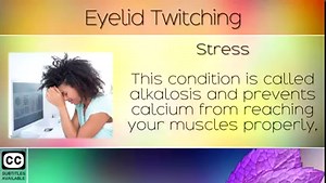 If you notice that your eyelid is twitching then you likely have a mineral imbalance. The small muscles below or above the eyelid begin to twitch involuntarily because they are not receiving enough calcium or magnesium. Eyelid twitches are usually caused by consuming to much phosphoric acid from soda drinks, caffeine, junk foods, stress or alkalosis. In today's video we will explain what causes eyelid twitching in more detail, and also how to cure eyelid these involuntary twitches naturally with