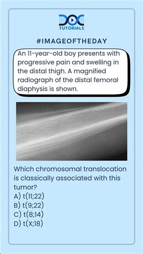 Which chromosomal translocation is classically associated with this tumor?