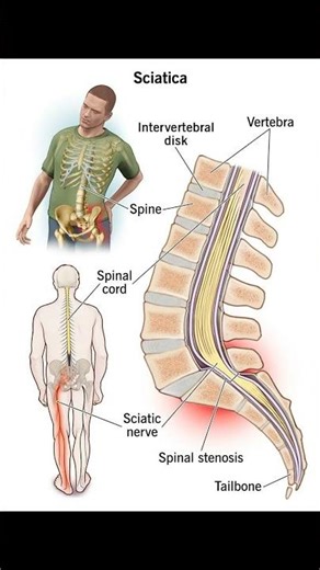 Flip Test of the Back | Quick Orthopedic Exam Explained #backpain #chiropractor #physiotherapy