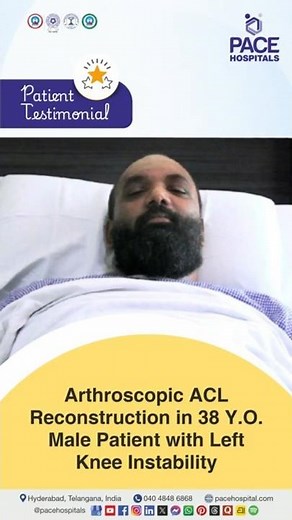 Patient Review - Successful Arthroscopic ACL Reconstruction for Left Knee Instability #acl