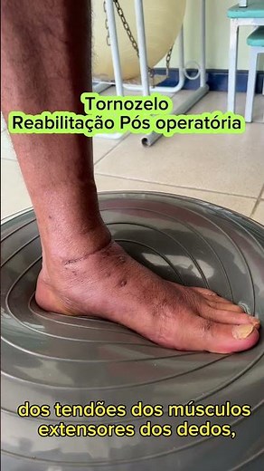 Ankle treatment - final phase in postoperative patient with talus fracture and tenorrhaphy