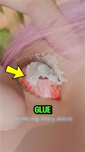 If You Ever Get Super Glue in Your Eye, Do This Immediately