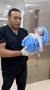 6.7M views · 115K reactions | #baby first moments of life | اسلام الدح | Facebook