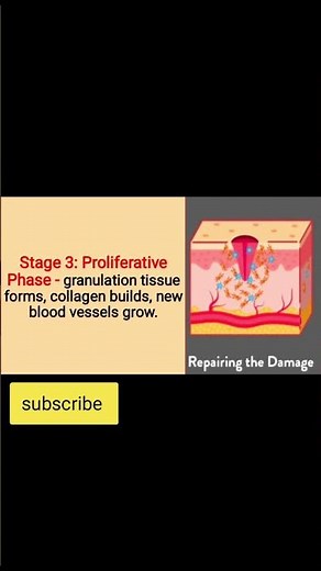 Stages of Wound Healing Explained in 30 Seconds | Nursing Made Easy