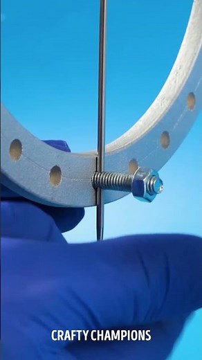 Simple Guide On Bone Growth Surgery! 🦴 The Ilizarov Technique Explanation 🔍