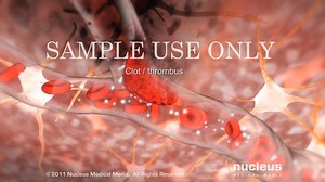 2.8K views · 65 reactions | Stroke | Medical Knowledge | Medical Knowledge | Facebook