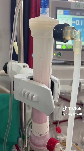 Understanding Stage 5 Chronic Kidney Disease and Dialysis
