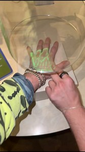 152K views · 335 reactions | The Vein Scanner!! | Jaden Sprinz | Facebook