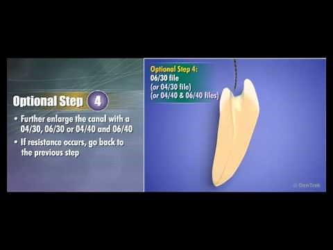 Hyflex CM NiTi Files