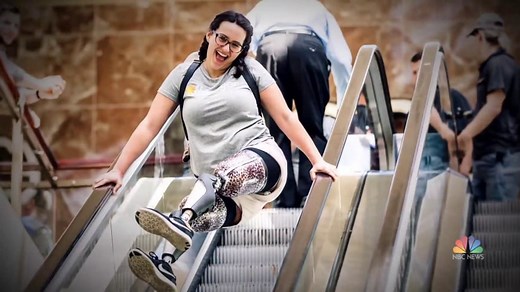 Woman inspired to become a nurse after losing both legs