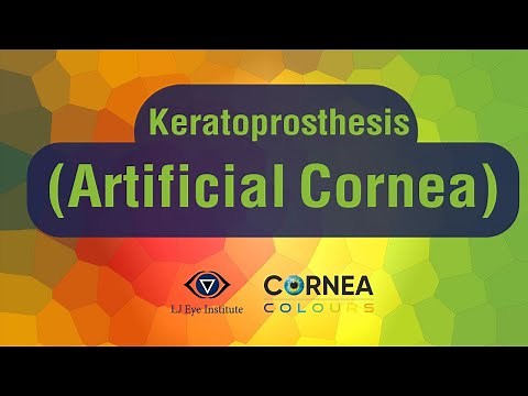 Cornea Colours | Keratoprosthesis (Artificial Cornea)