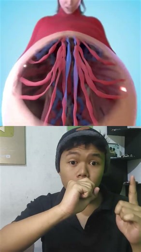 Akibat makan 50 burger sehari🤔😭