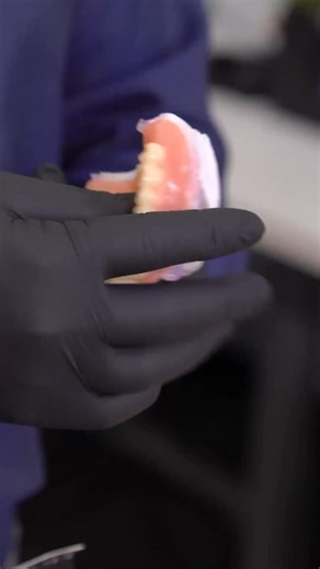 Thanks to the folks at @pac_dent for sending us their Rodin denture soft reline kit to test and review with @drferguson! Keep an eye out for the full video! #digitaldenture #denture #dental #dentistry #dentallab | Evident