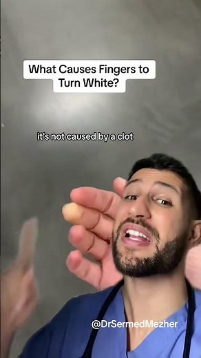 What Causes Fingers to Turn White #health Fingers turning white, a condition often referred to as "w