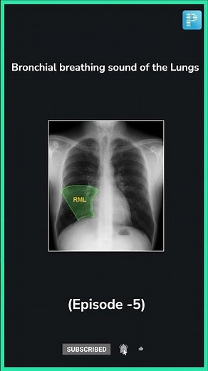 Bronchial breathing Sound in the Lungs [Cause + Treatment] #Episode5