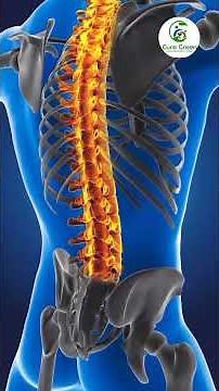 Disc prolapse