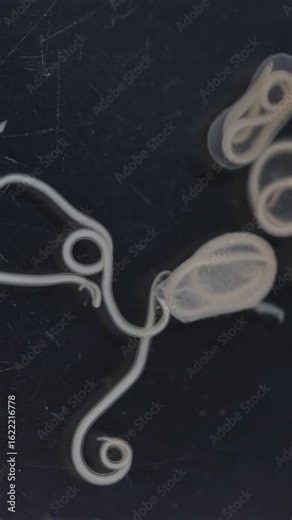 The nematodes (Nematoda), roundworms or eelworms constitute the phylum Nematoda. Species in the phylum inhabit a broad range of environments. Found in freshwater crabs. Stock Video