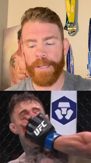 My thoughts on the eye poke this last weekend 😕 | Paul "The Irish Dragon" Felder