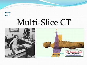 Multi-Slice CT - SlideServe