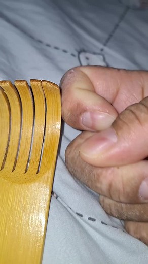 Understanding Eczema Itch Relief Techniques