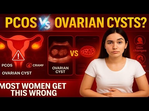 PCOS vs. Ovarian Cysts: What’s the Difference? Is PCOS the Same as Ovarian Cysts?