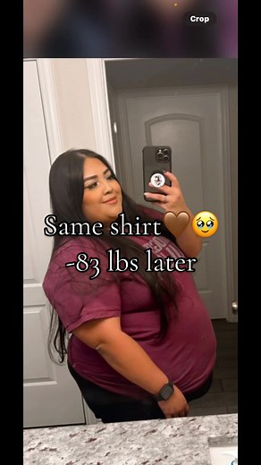 Semaglutide Weight Loss Journey: How I Reversed Pre Diabetes -83 lbs