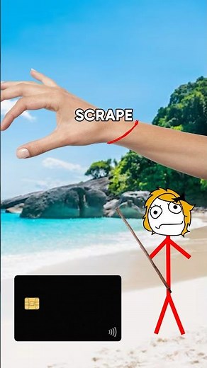 What to DO when STUNG by a JELLYFISH!!🪼 #shorts #survival