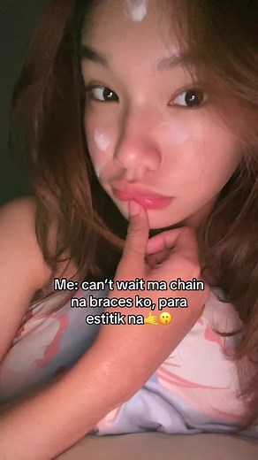 Tiis Ganda: Dealing with Braces Installation