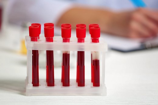 Leucocytes (globules blancs) : bas, hauts, cause, taux normal