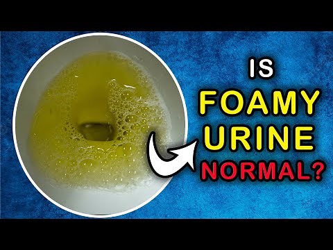Is it NORMAL to have a FOAMY URINE: Cause and Treatment
