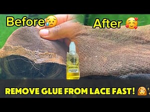 How to Easily Remove Glue from Your Lace Frontal | Quick & Simple Method”