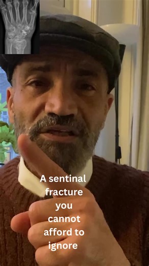 Wrist Fracture Warning Signs in Your 50s and 60s