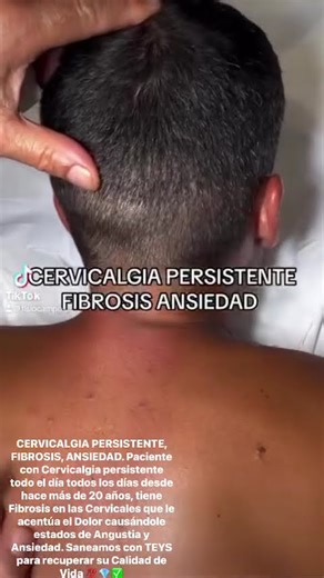 CERVICALGIA PERSISTENTE