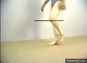 7.1. Steppage Gait / Drop Foot Gait - Swing Phase Abnormalities - Normal and Abnormal Gait Series on Make a GIF