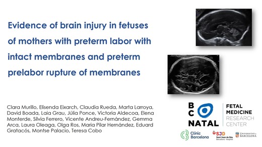 2.3K views · 59 reactions | AJOG Presents: Evidence of brain injury in fetuses of mothers with preterm labor with intact membranes and preterm premature rupture of membranes https://ow.ly/ytmB50UwUtC | American Journal of Obstetrics & Gynecology | Facebook