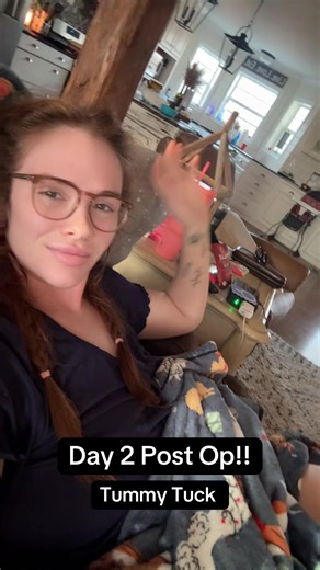 Tummy Tuck Recovery: Day 2 Insights