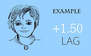 【中英双字】【MEM动态检影】MEM Retinoscopy