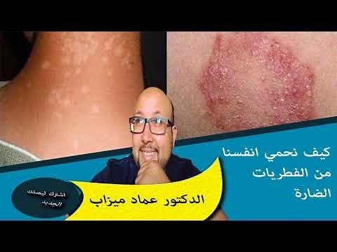 كيف نحمي انفسنا من فطريات الجلد الضارة خاصة في المناطق الحساسة الدكتور عماد ميزاب