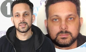 Dynamo reveals swollen face thanks to Crohn's disease in shocking