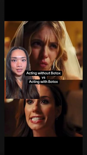 A scene from Euphoria Season 3 is going viral as viewers point out how noticeably different actors look, sparking debate over how things like Botox and cosmetic tweaks are changing the feel of on-screen performances. Do you agree? #euphoria #cassie #sydneysweeney #botox #acting