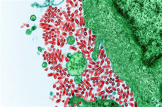 Rabies is an ancient, unpredictable and potentially fatal disease − Two rabies researchers explain how to protect yourself