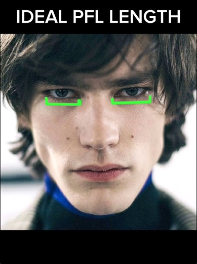 Understanding Palpebral Fissure Length in Facial Aesthetics