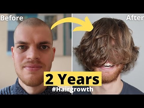 💇🏻💈Hair Growth Time Lapse 2 Years (24 Months) Men - From Buzz Cut