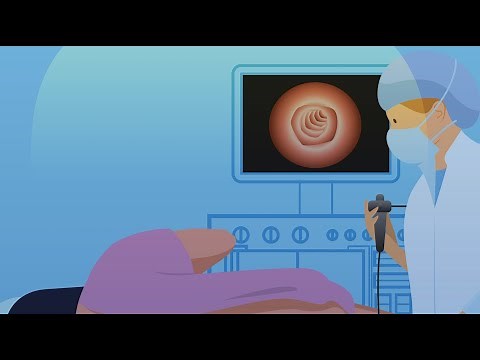 What Happens During a Colonoscopy: What The Health