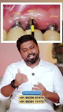 What Are Periodontal Pockets? | Dr.Prem Alex Lawrence