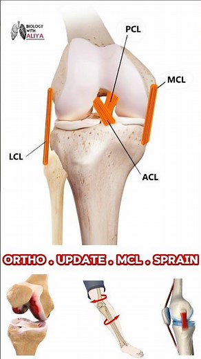 Management and Treatment of MCL Sprains in Adults #medical #animation #3d #short